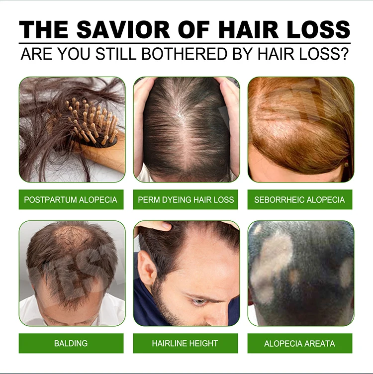 Hair Growth Treatment Spray